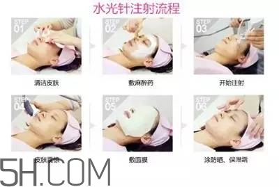 打水光針多久打一次？水光針的誤區(qū)