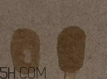 太陽社玻尿酸孕婦能用嗎？怎樣辯別真假太陽社玻尿酸？