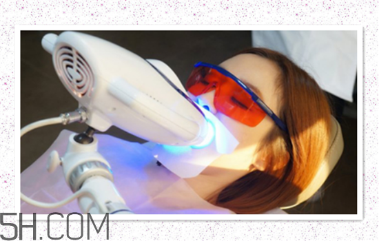 超聲波洗牙可以美白牙齒嗎？超聲波洗牙多少錢一次？