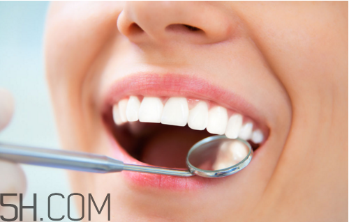 哪些情況不宜洗牙？洗牙后要注意什么？