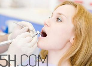 烤瓷牙洗牙要注意什么？洗牙的危害