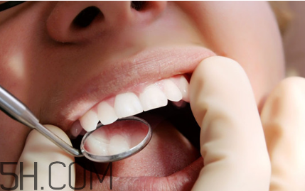 洗牙后牙縫變大是怎么回事？怎么保持牙齒潔白？