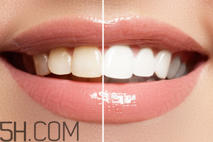 牙齒內(nèi)側(cè)的黃垢怎么去除？每天刷幾次牙齒最合適？