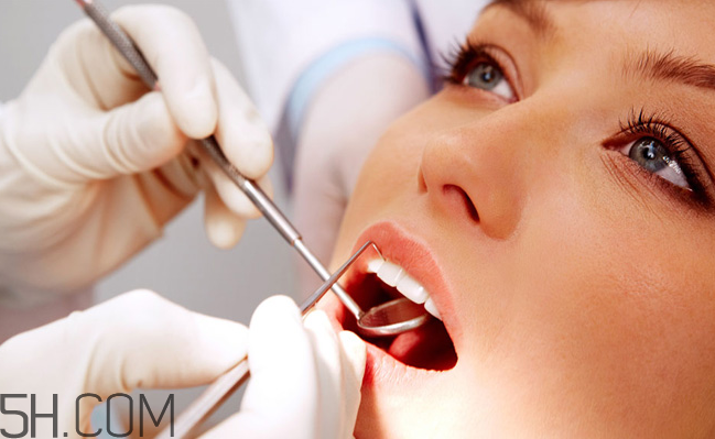 哪些情況不宜洗牙？洗牙后要注意什么？