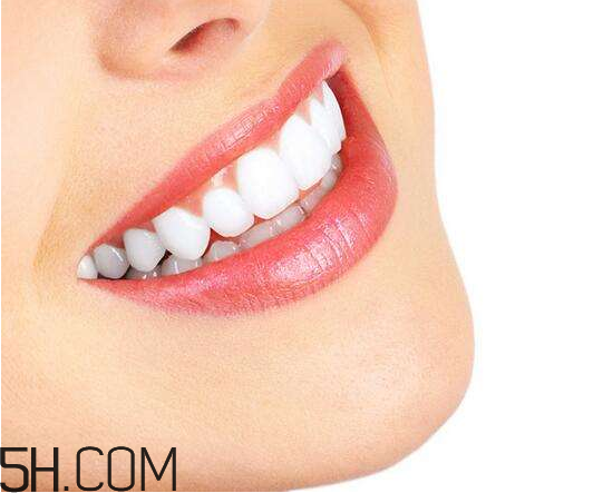 烤瓷牙為什么會有縫隙？烤瓷牙的注意事項(xiàng)有哪些？