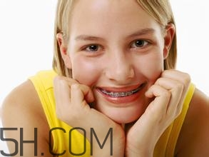 補牙需要帶牙套嗎？補牙后要裝牙套多少錢？