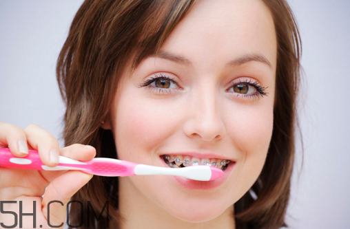 戴牙套可以懷孕嗎？牙齒矯正的后遺癥