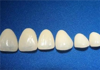 牙齒做貼面多少錢一顆？烤瓷牙可以取下來嗎？