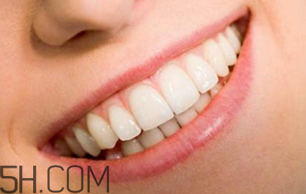 牙齒做貼面多少錢一顆？烤瓷牙可以取下來嗎？