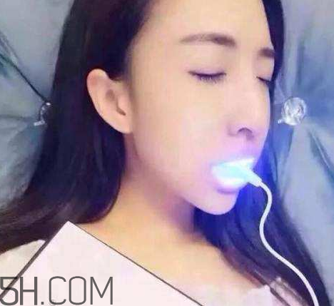 美牙儀可以兩個(gè)人用嗎？美牙儀用多久才有作用？