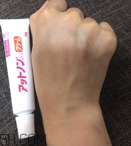 小林制藥祛疤膏有效嗎？小林制藥祛疤膏怎么樣？