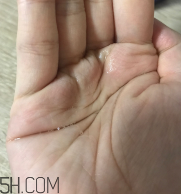 雪肌精卸妝油糊眼睛嗎？雪肌精卸妝油悶痘嗎？