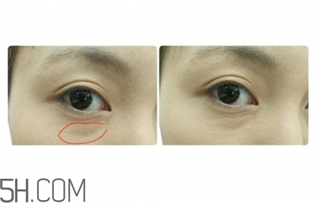 遮瑕膏前用什么 如何用遮瑕膏 遮瑕膏前用什么 如何用遮瑕膏