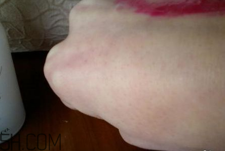 芭妮蘭卸妝膏用了長閉口怎么辦？芭妮蘭卸妝膏孕婦可以用嗎？