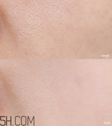 蘭蔻小黑瓶小嫩膜和前男友面膜哪個(gè)好？