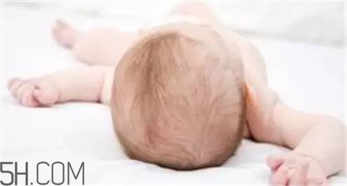 寶寶濕疹媽媽吃哪些食物比較好？寶寶秋冬脫發(fā)要怎么辦？