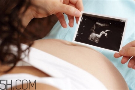 胎兒缺氧胎心會(huì)正常嗎？胎兒缺氧還會(huì)打嗝嗎？