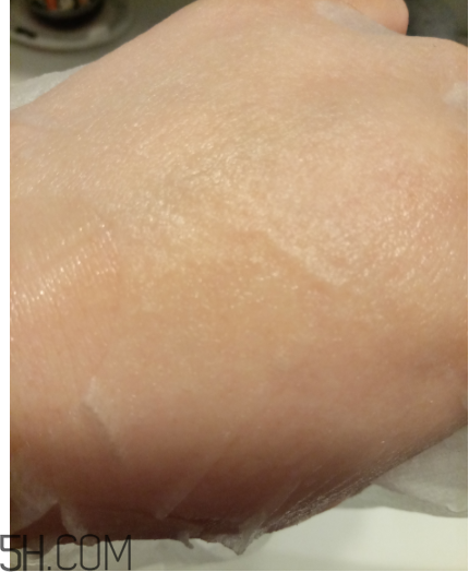 WIS痘肌修護(hù)面膜有效嗎？適合敏感肌嗎？