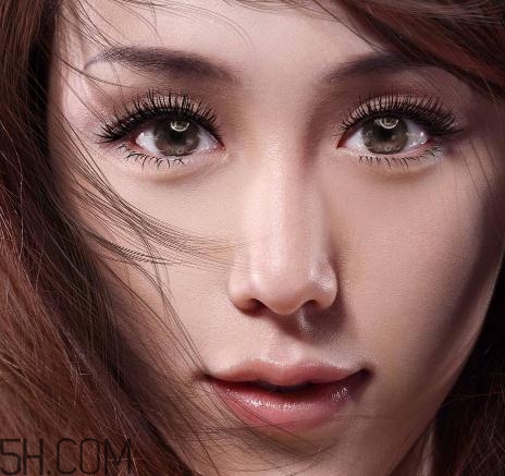 上瞼提肌手術有必要嗎？上瞼提肌后是永久的嗎？