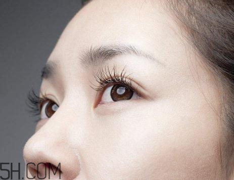 上瞼提肌手術有必要嗎？上瞼提肌后是永久的嗎？