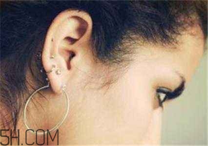 打耳洞后該如何預(yù)防感染？打耳洞前需要注意的細(xì)節(jié)？