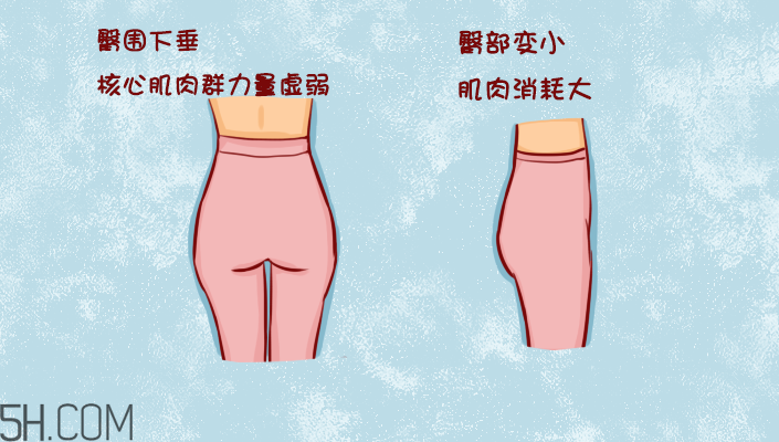 臀部護(hù)理對(duì)健康有什么影響？日常如何保養(yǎng)臀部健康？