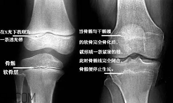 孩子學街舞好不好？學街舞好處多多