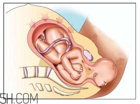分娩如斷骨？分娩痛感沒那么夸張