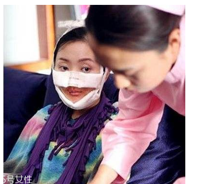 幻丑癥有多可怕？極端時(shí)會(huì)自戕