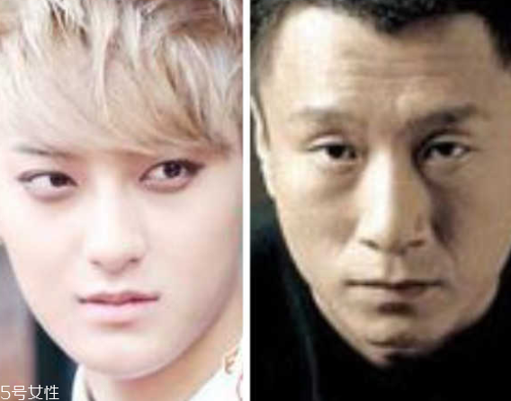 死魚(yú)眼怎么治？割雙眼皮可以治死魚(yú)眼