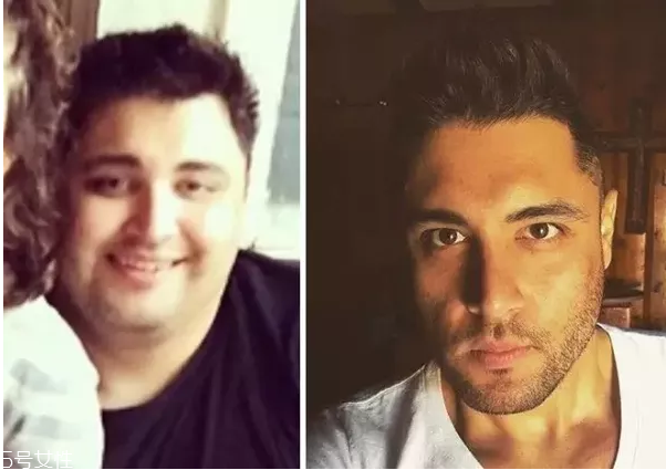 減肥對(duì)外貌的改變有多大？運(yùn)動(dòng)減肥的相關(guān)問題