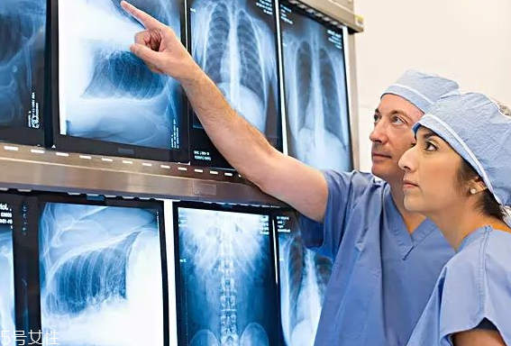 癌癥篩查有哪些真相？查與不查一個樣