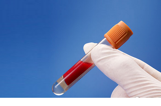 血里的垃圾有哪些？油脂過多成為垃圾油