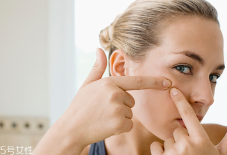 長痘的根源是什么？原來是吃糖過多