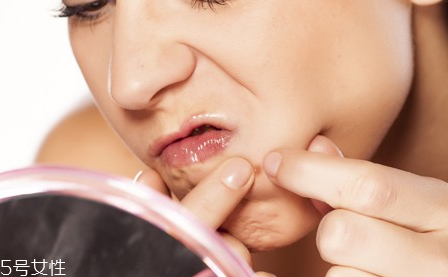 長痘的根源是什么？原來是吃糖過多