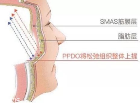 大v線會斷嗎？一定要選擇正規(guī)整形醫(yī)院