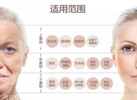 大v線會斷嗎？一定要選擇正規(guī)整形醫(yī)院