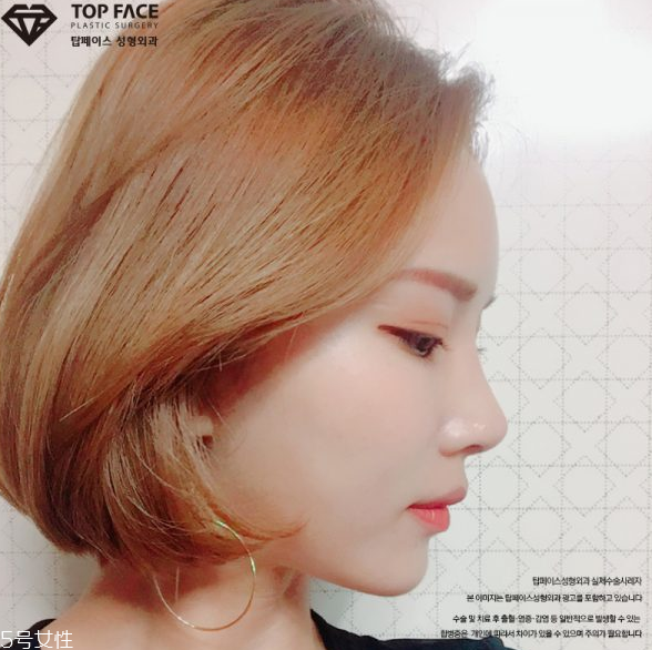 韓國人最愛整哪兒？韓國整形部位TOP4