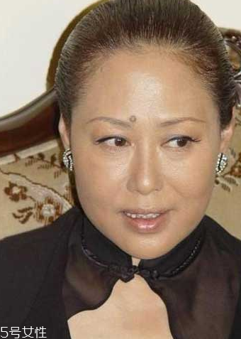 痣能摳掉嗎？這幾種痣摳掉會(huì)成瘤