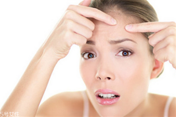 額頭毛孔粗大用什么護(hù)膚品？額頭毛孔粗大和出油有關(guān)系