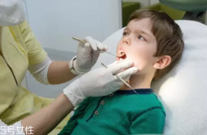 牙結(jié)石能自動脫落嗎？除了洗牙別無他法