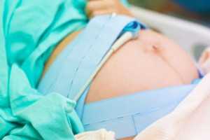 剖腹產(chǎn)坐月子該注意什么？保護(hù)傷口是關(guān)鍵