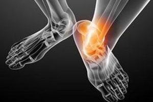 痛風跟飲食有關？痛風更多與遺傳有關