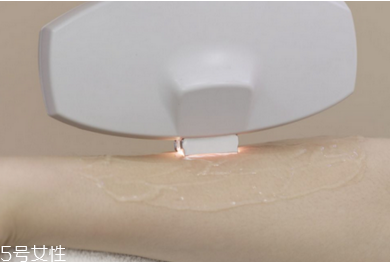 激光脫毛有哪些優(yōu)勢(shì)？激光脫毛的方式