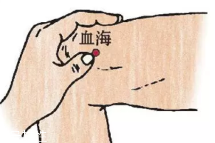 濕疹怎么治才管用？內(nèi)外同治是關(guān)鍵