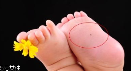 痣什么情況下會(huì)轉(zhuǎn)變?yōu)榱?？點(diǎn)痣不可取