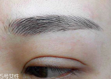 激光洗眉恢復(fù)期有疤痕怎么辦？激光洗眉毛之后正確護理方法