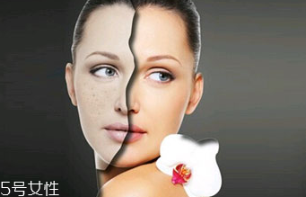 點痣的危害有哪些？激光點痣后的飲食禁忌