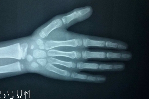 哪些人需要測(cè)骨齡？長(zhǎng)太快警惕骨齡提前