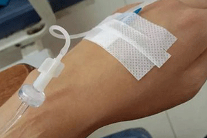 輸液治療不適合哪些?。窟^敏反應危害大